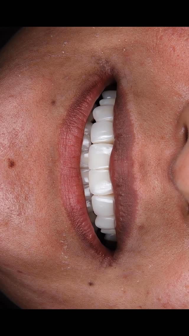 Post 2 by Face Studio Clinic | Skin, Dental & Aesthetics on Instagram (video)