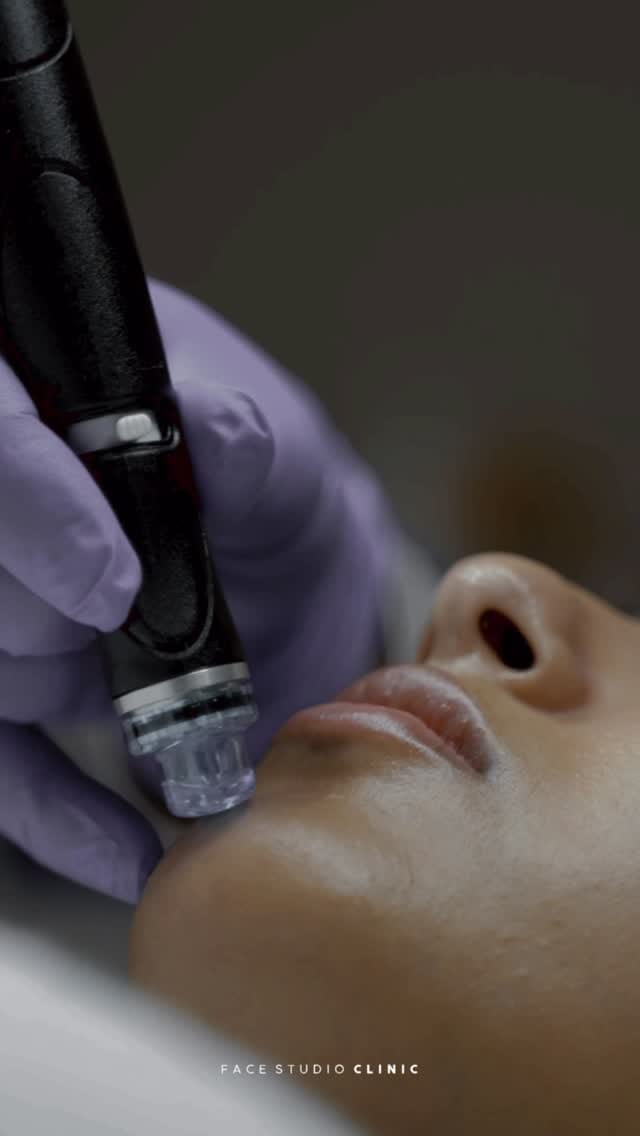 Post 5 by Face Studio Clinic | Skin, Dental & Aesthetics on Instagram (video)