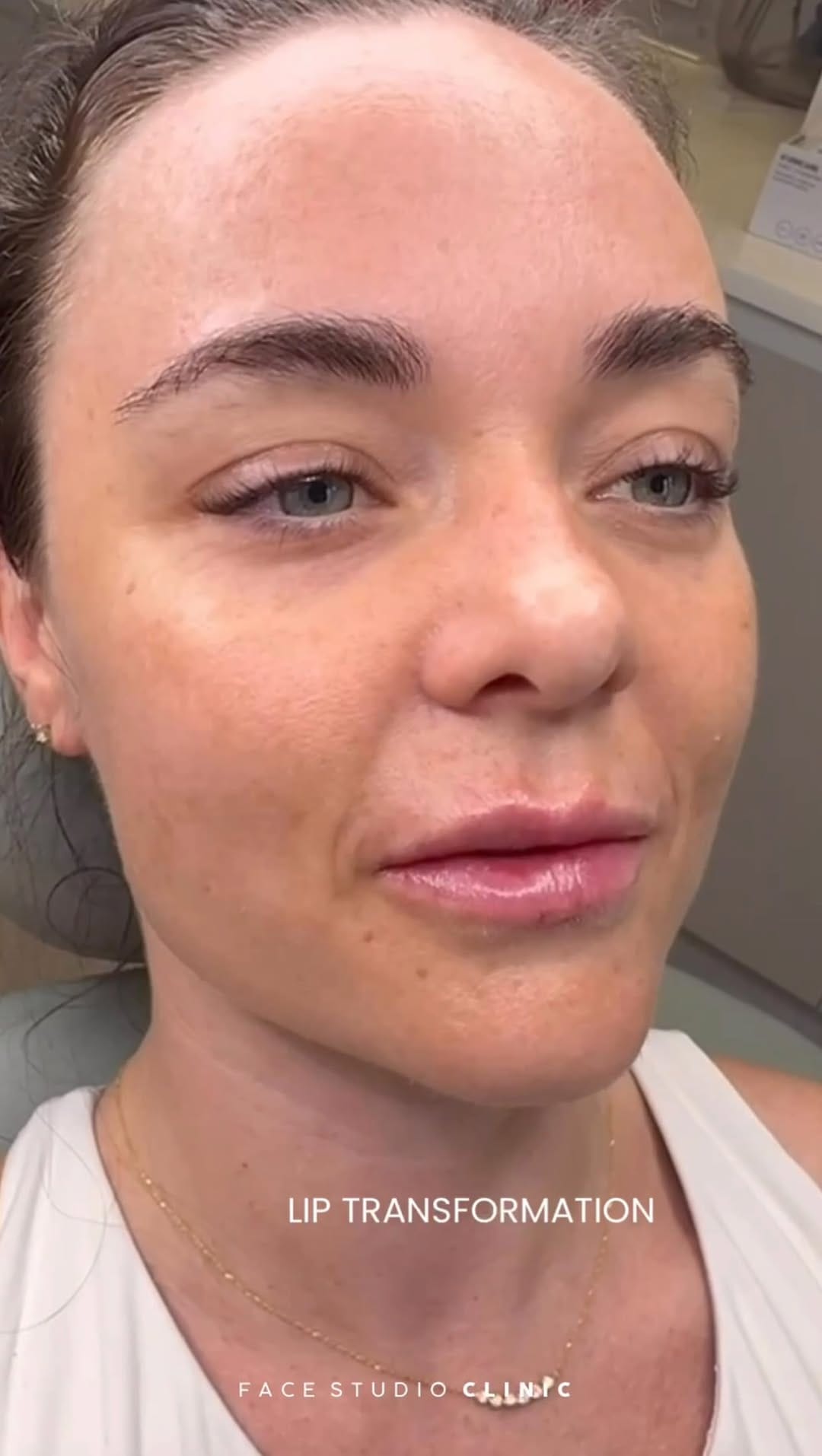 Post 4 by Face Studio Clinic | Skin, Dental & Aesthetics on Instagram (video)
