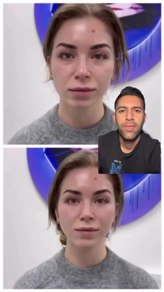 Post 3 by AMS Aesthetics on Instagram (video)