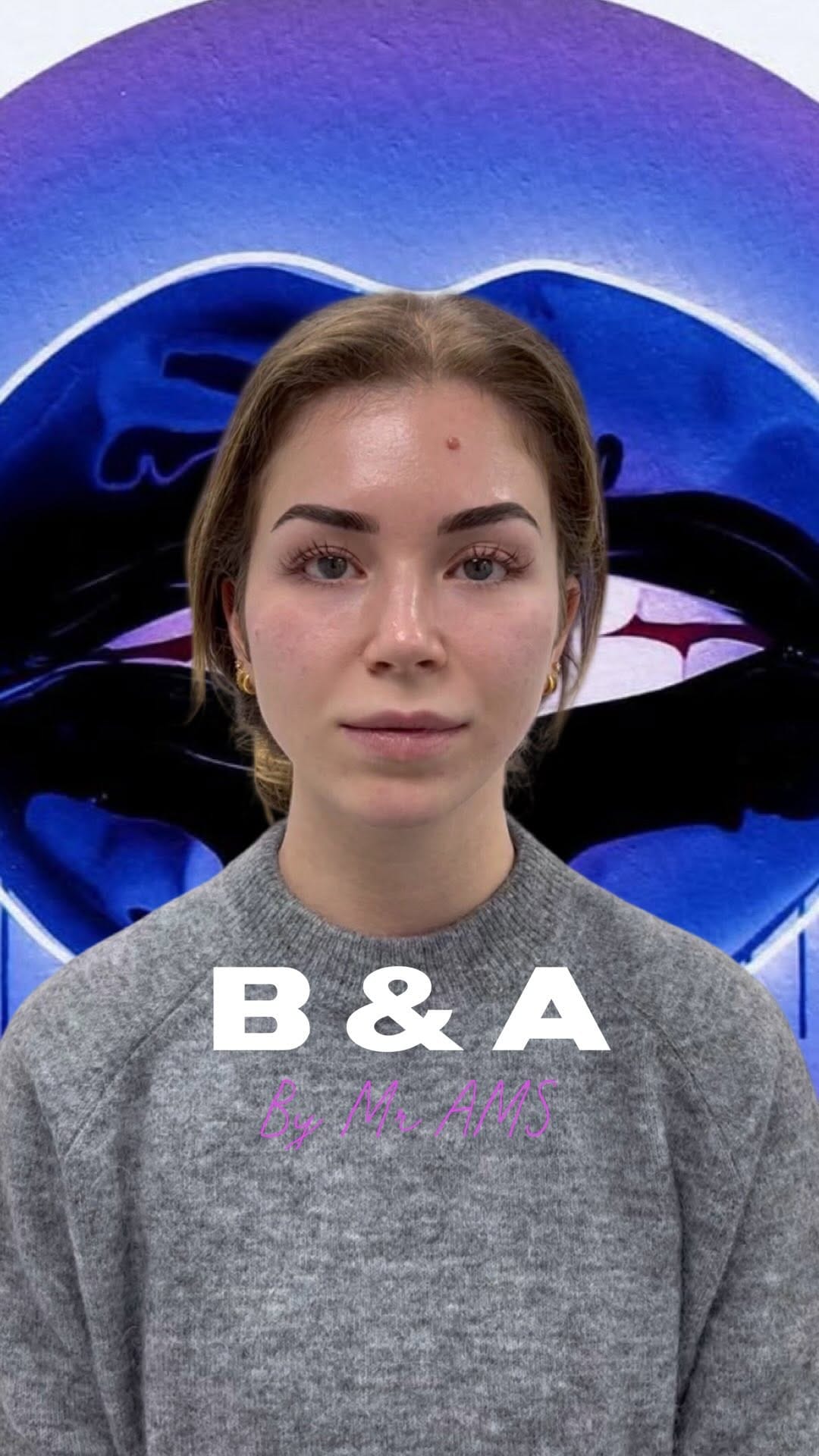 Post 4 by AMS Aesthetics on Instagram (video)