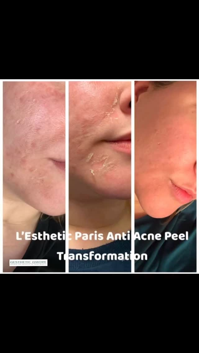 Post 7 by AESTHETIC AMORE on Instagram (video)