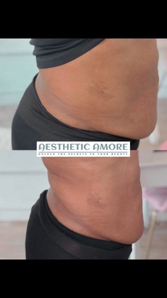 Post 5 by AESTHETIC AMORE on Instagram (video)