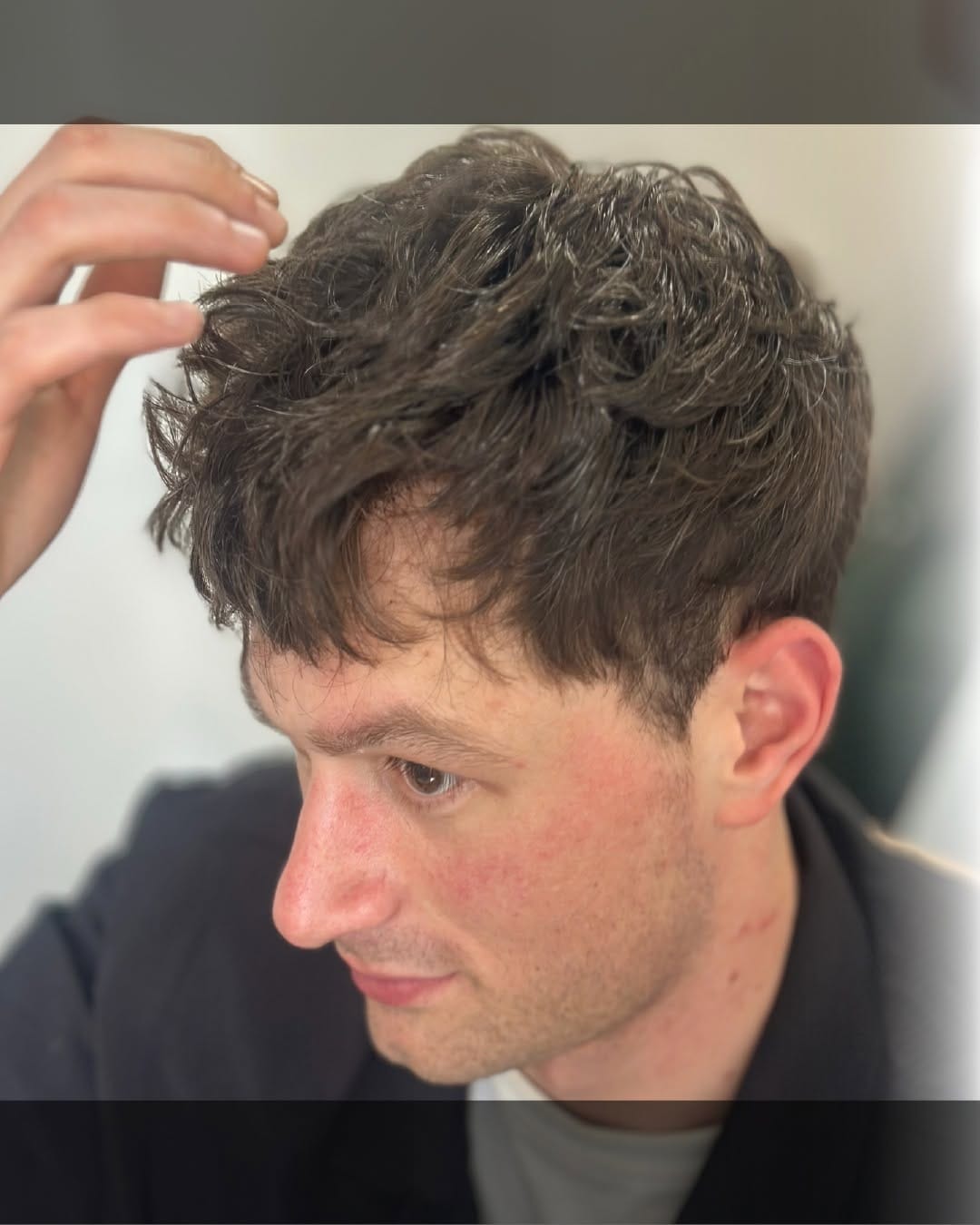 Post 7 by Hair Hotel • Protez Saç on Instagram (carousel)