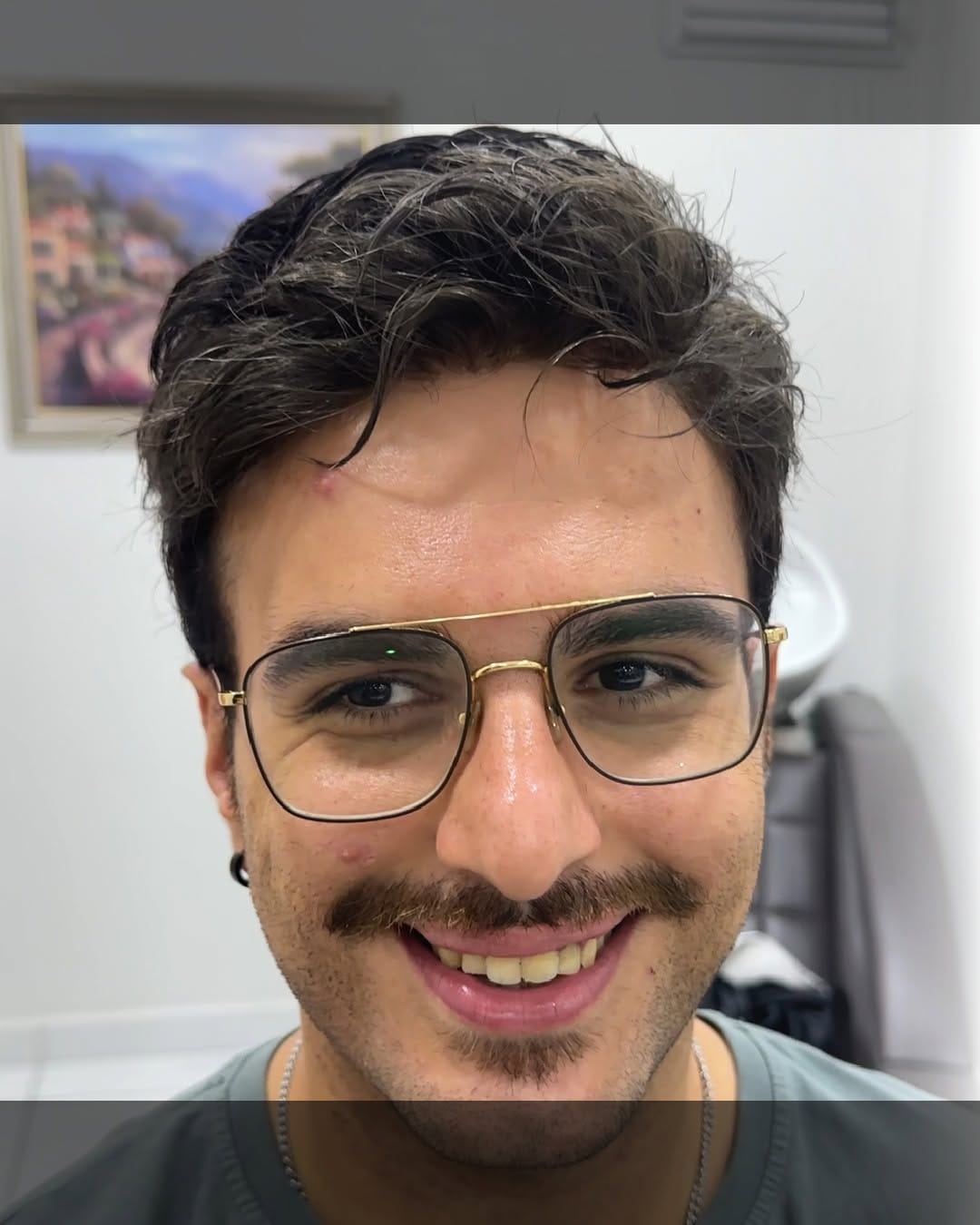 Post 4 by Hair Hotel • Protez Saç on Instagram (carousel)