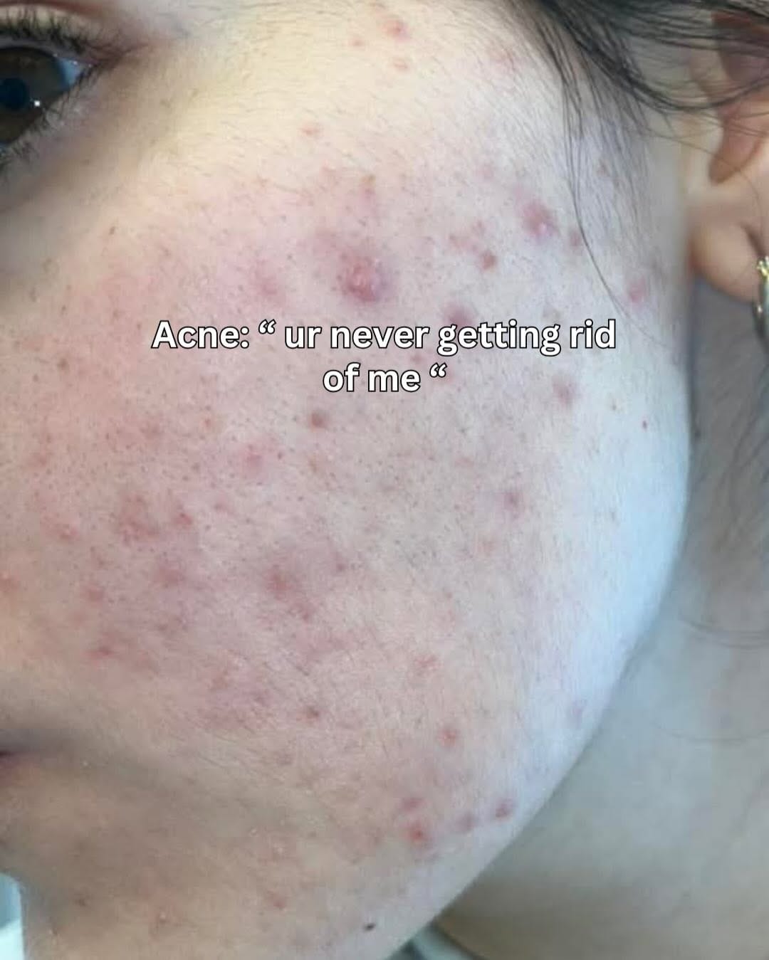 Post 7 by Zosia |  Skincare Content Creator on Instagram (carousel)
