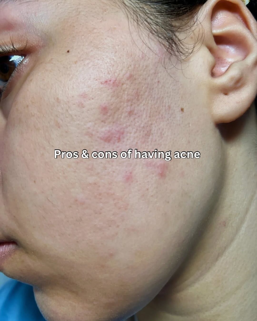 Post 8 by Zosia |  Skincare Content Creator on Instagram (carousel)