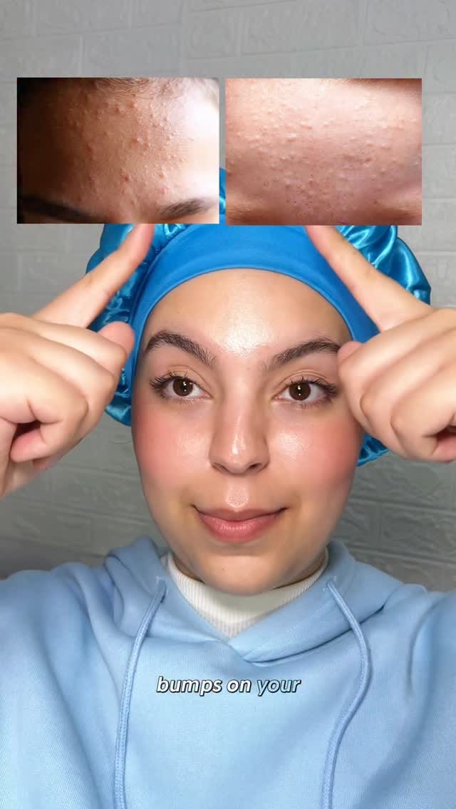 Post 3 by Zosia |  Skincare Content Creator on Instagram (video)
