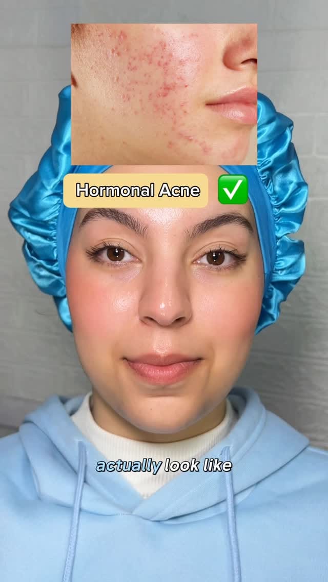 Post 4 by Zosia |  Skincare Content Creator on Instagram (video)