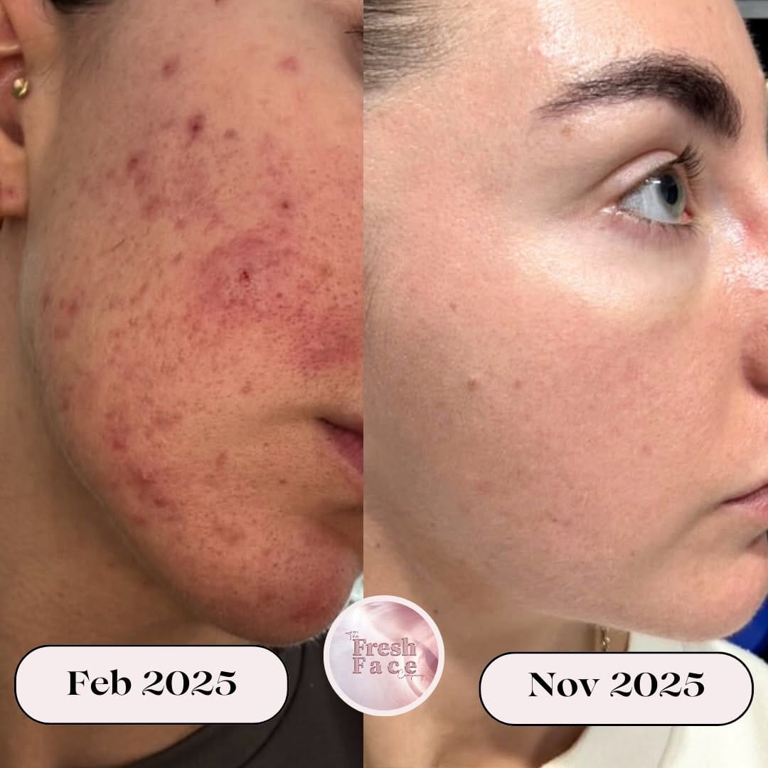 Post 5 by RACHAEL M - The Fresh Face Company ™ ✨ on Instagram (carousel)