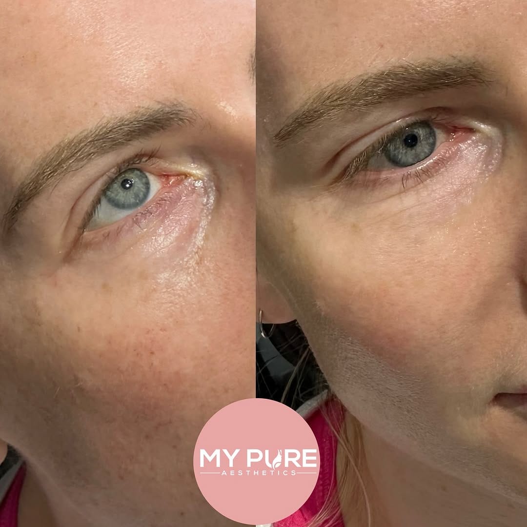 Post 7 by My Pure Aesthetics on Instagram (image)