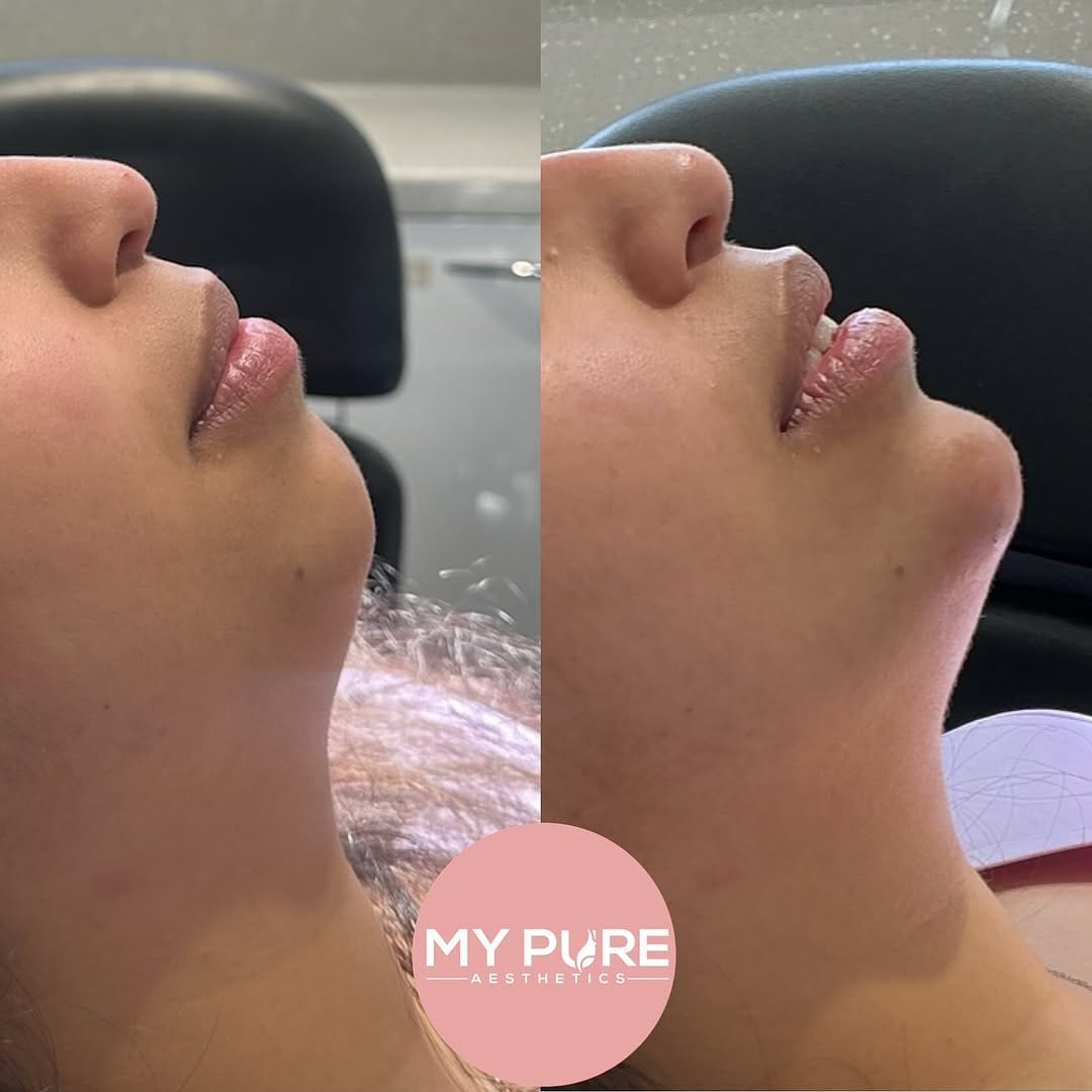 Post 9 by My Pure Aesthetics on Instagram (image)
