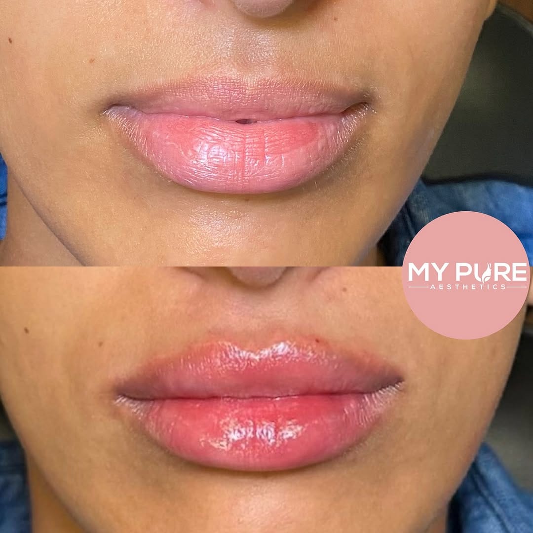 Post 3 by My Pure Aesthetics on Instagram (image)