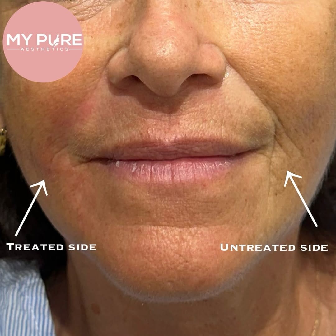 Post 5 by My Pure Aesthetics on Instagram (image)