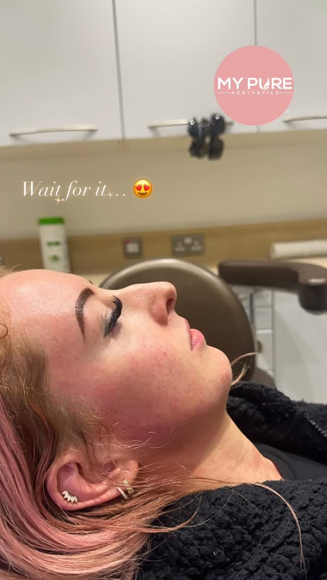 Post 2 by My Pure Aesthetics on Instagram (video)