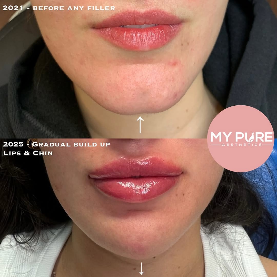 Post 4 by My Pure Aesthetics on Instagram (image)