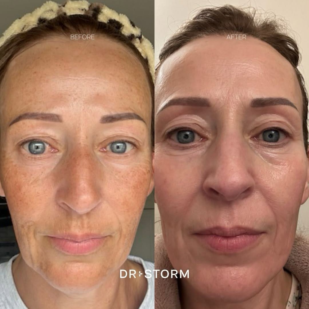 Post 8 by Doctor-led skincare brand on Instagram (carousel)