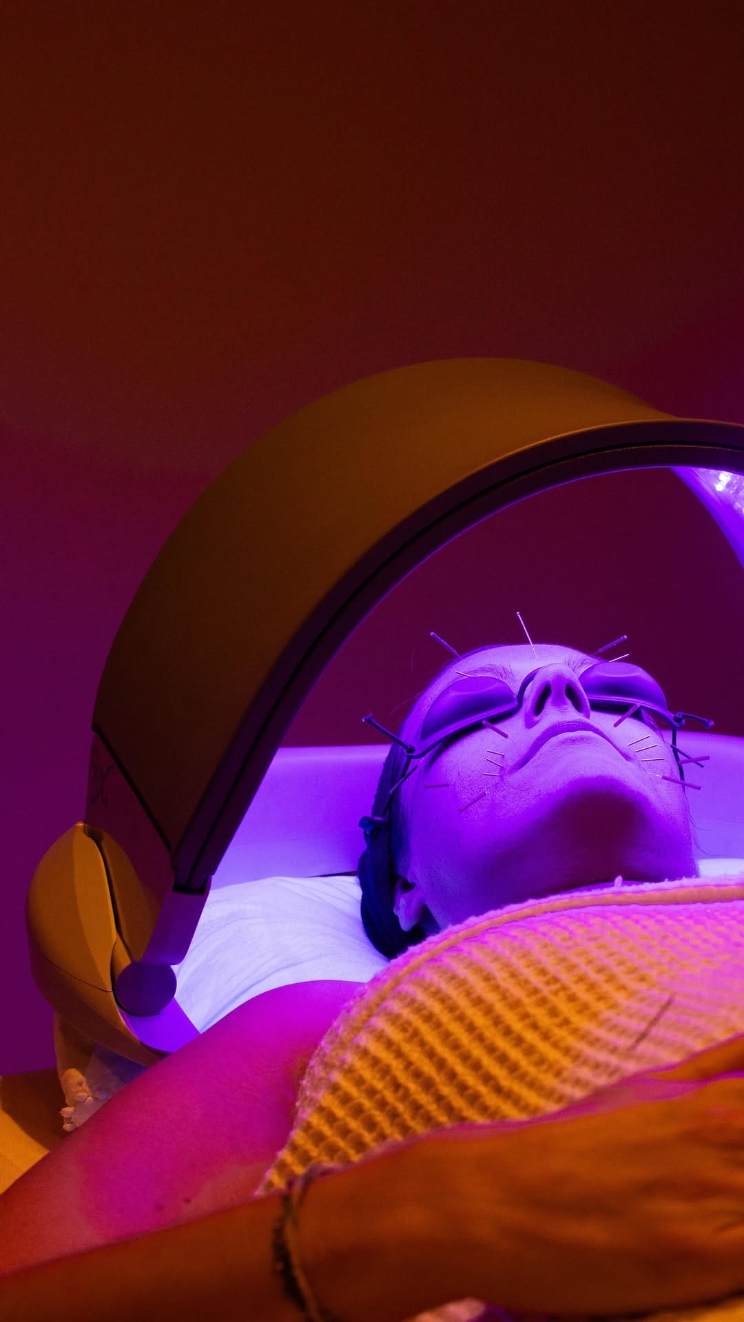 Post 5 by Pricc - Acupuncture & Wellness Studios on Instagram (video)
