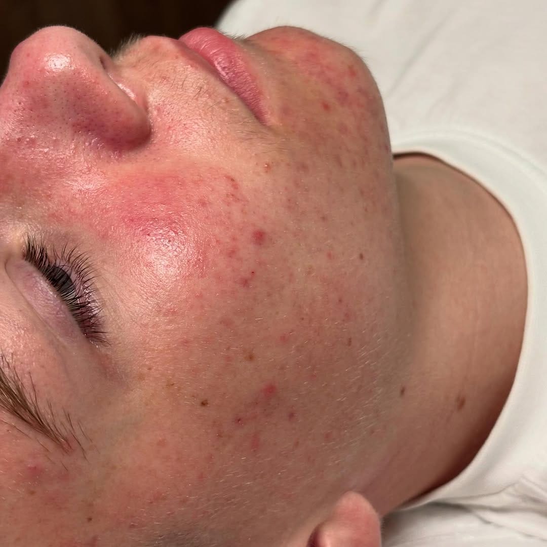 Post 7 by Cleanse by Lauren Anna | Facial Skincare Specialist | Dubai on Instagram (image)