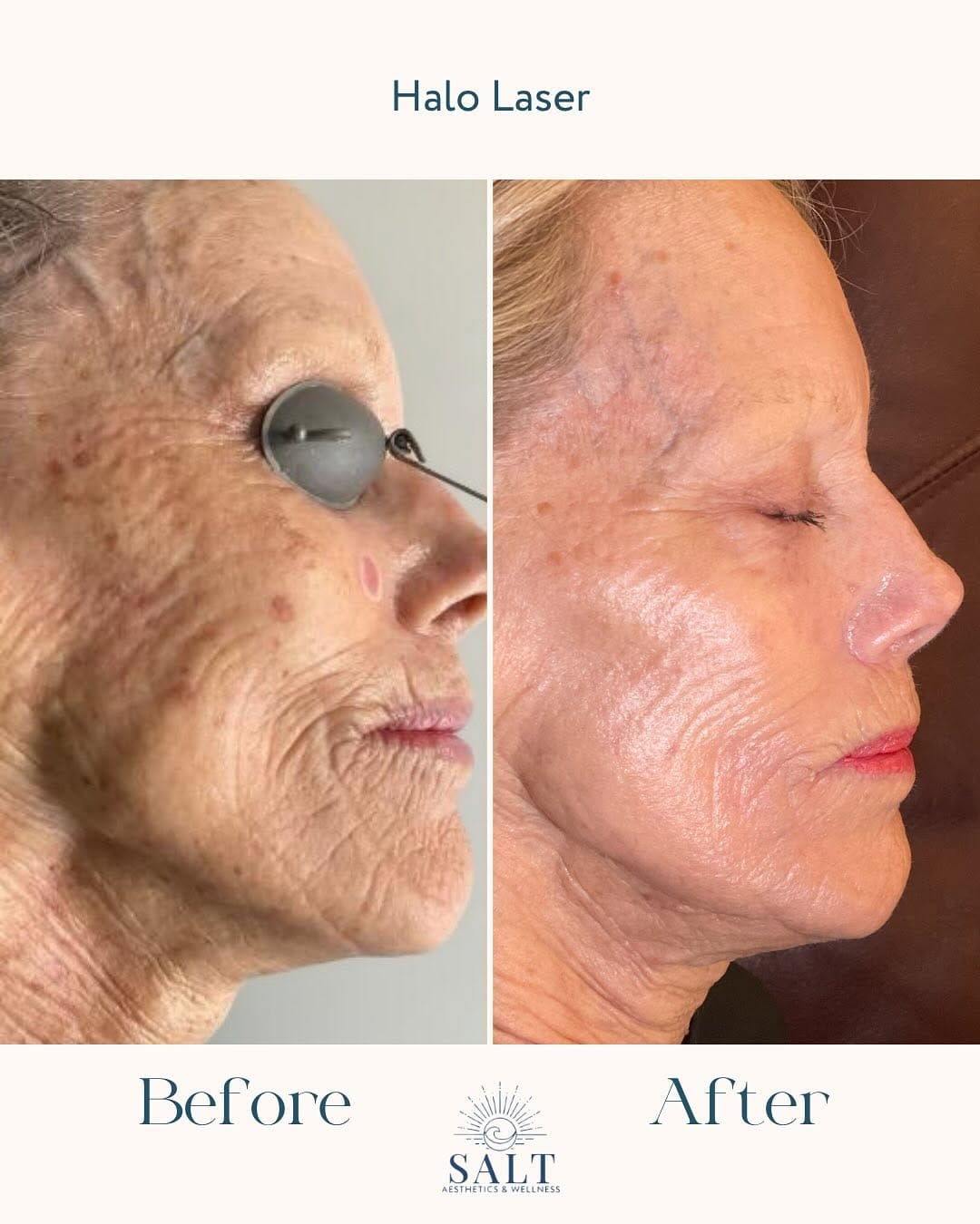 Post 10 by Wilmington Medspa & Weight Loss on Instagram (carousel)