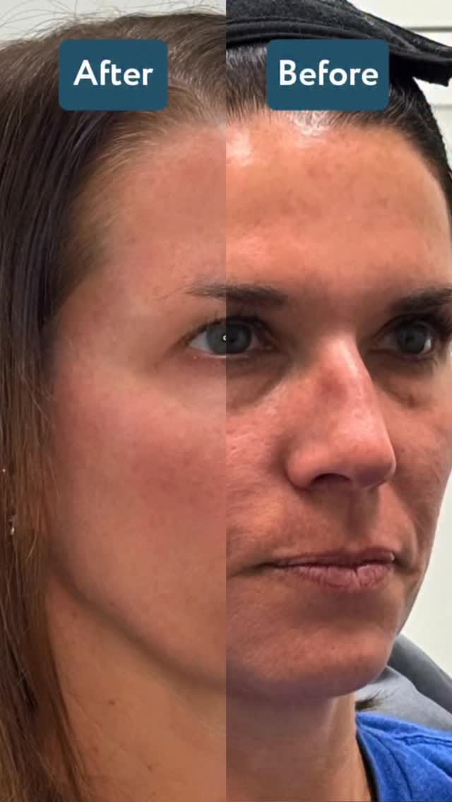 Post 3 by Wilmington Medspa & Weight Loss on Instagram (video)