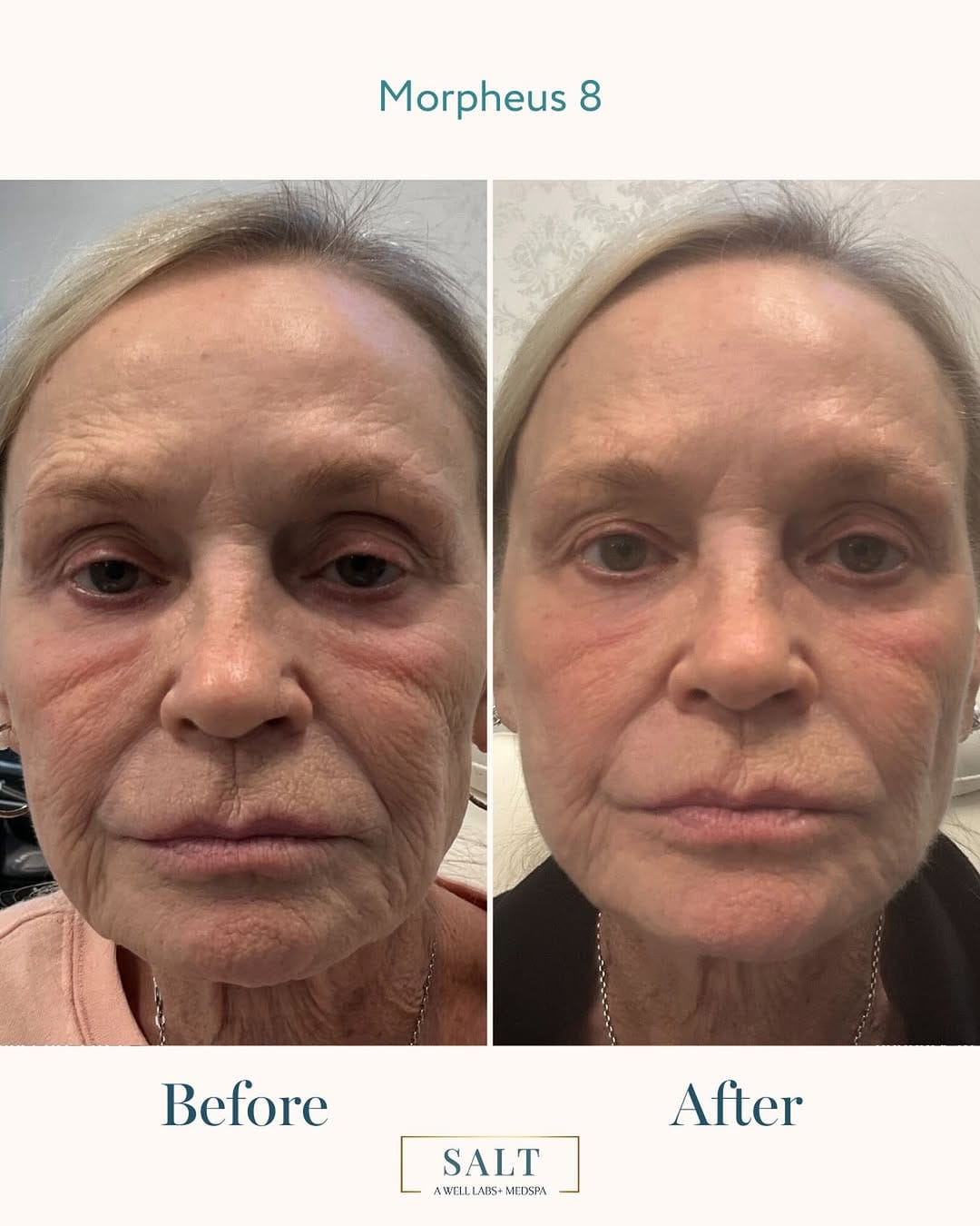 Post 7 by Wilmington Medspa & Weight Loss on Instagram (image)
