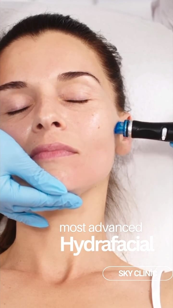 Post 4 by Sky Clinic UK on Instagram (video)