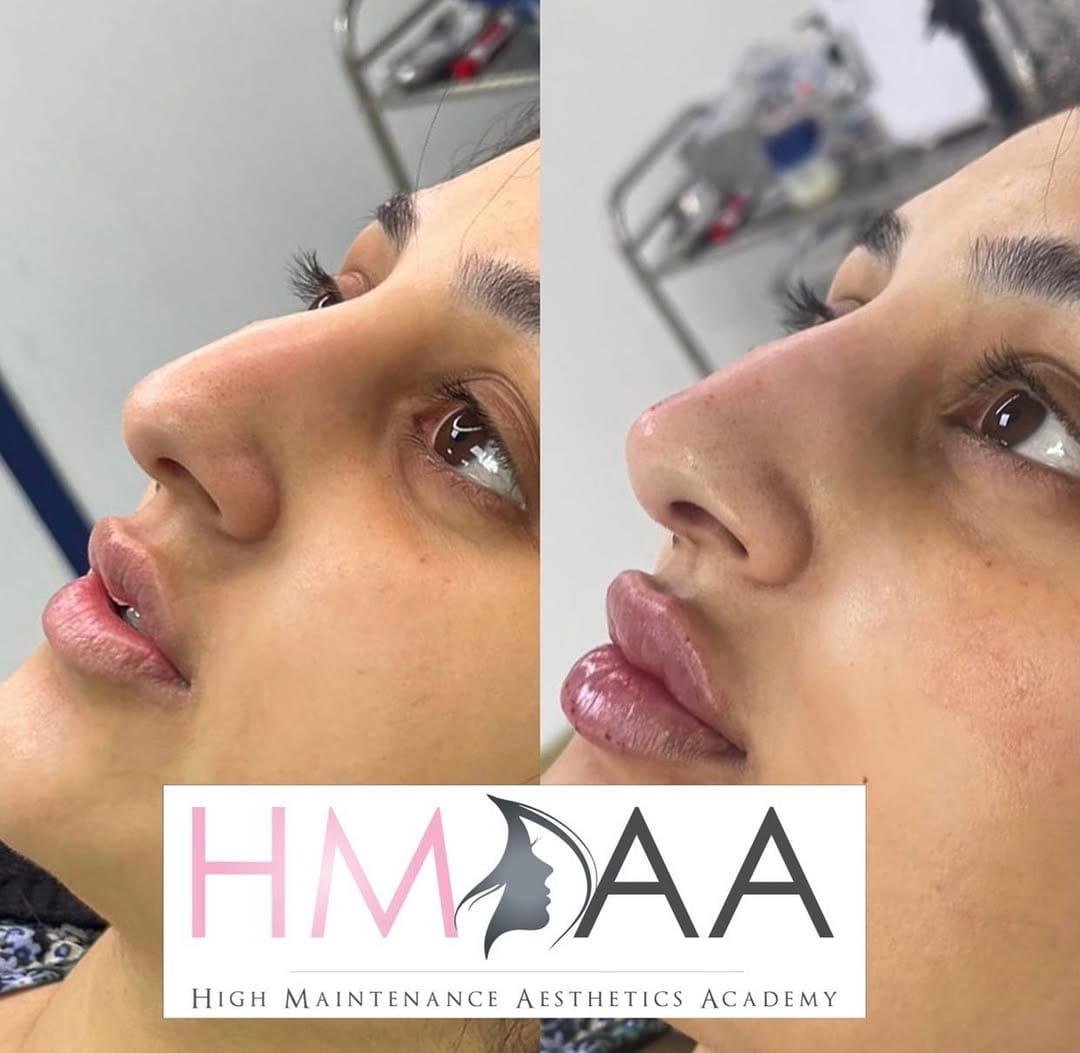 Post 4 by HIGH-MAINTENANCE AESTHETICS on Instagram (image)