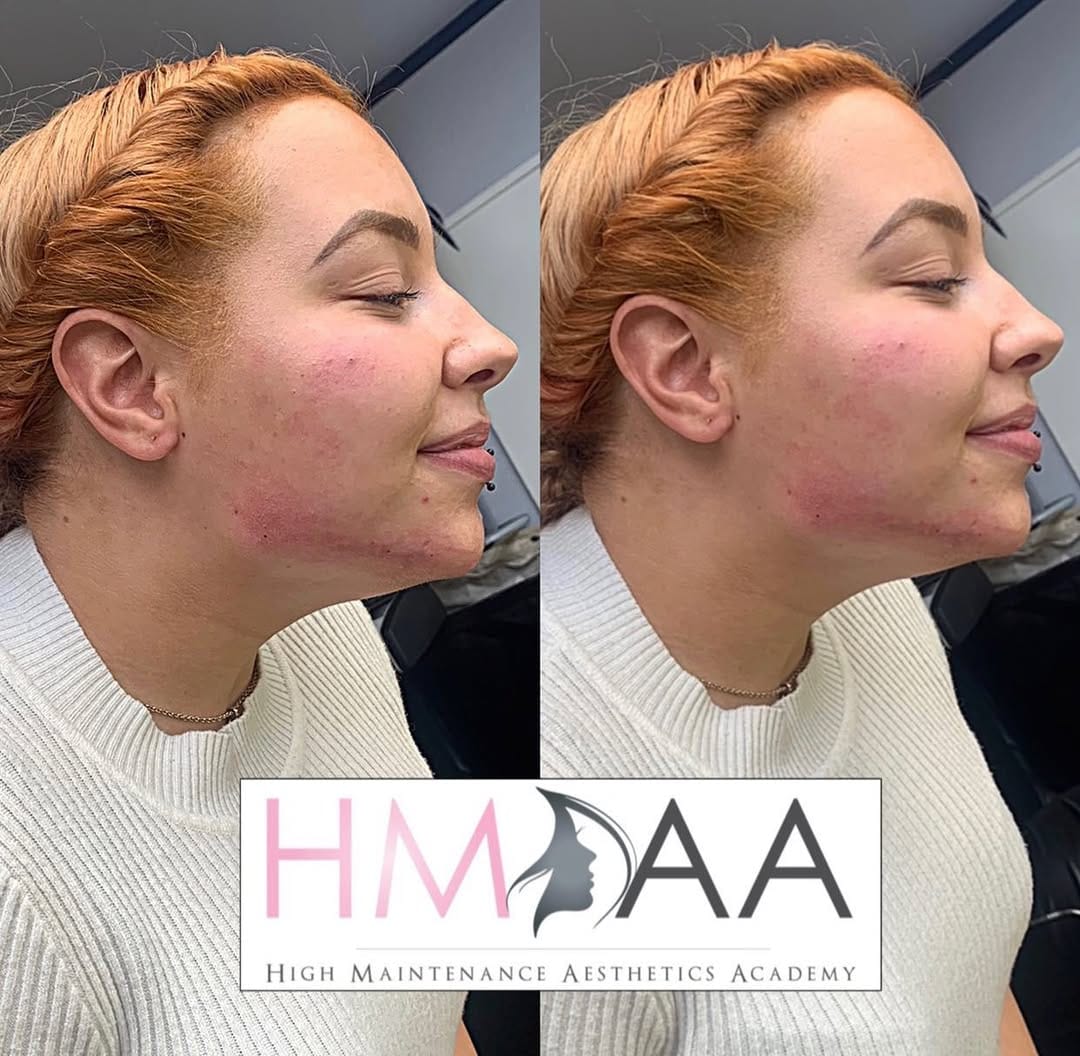 Post 5 by HIGH-MAINTENANCE AESTHETICS on Instagram (image)