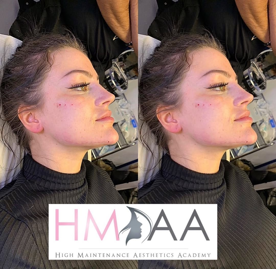Post 6 by HIGH-MAINTENANCE AESTHETICS on Instagram (image)