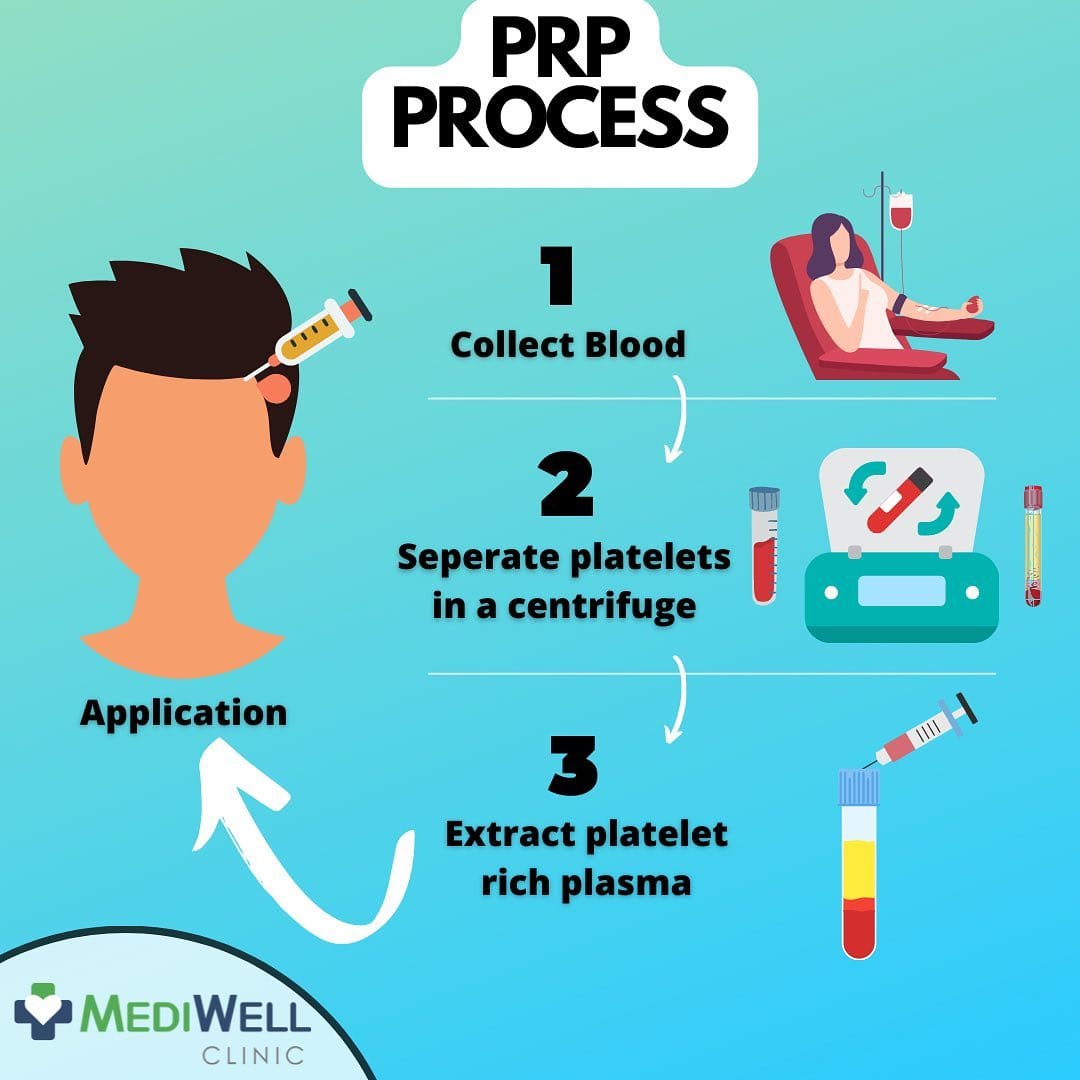 Post 6 by MediWell Hair Clinic on Instagram (image)
