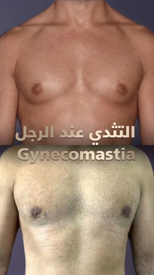 Post 10 by Bizrahmed 🤍 بزرة ميد on Instagram (video)