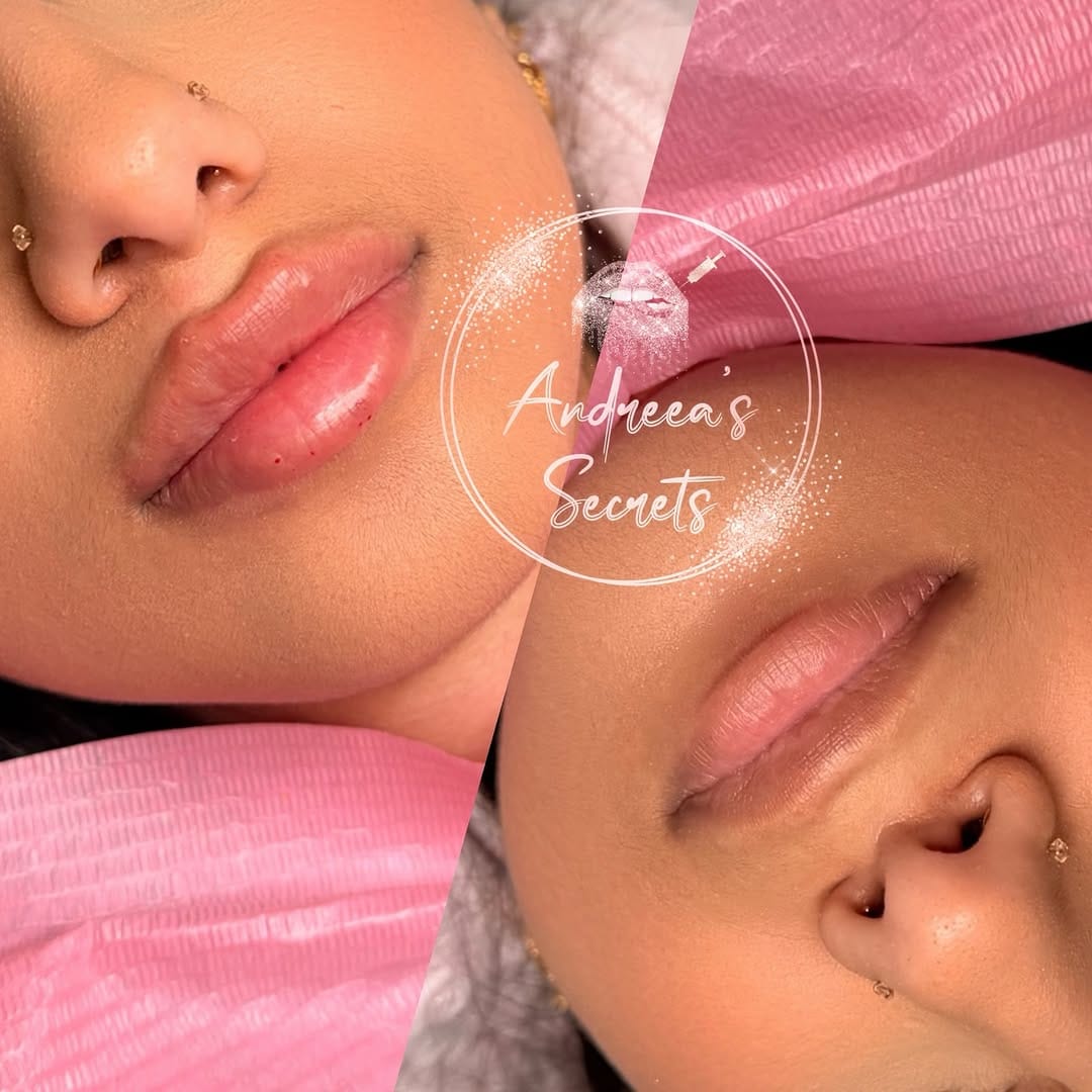 Post 9 by Andreea Rasinar on Instagram (image)