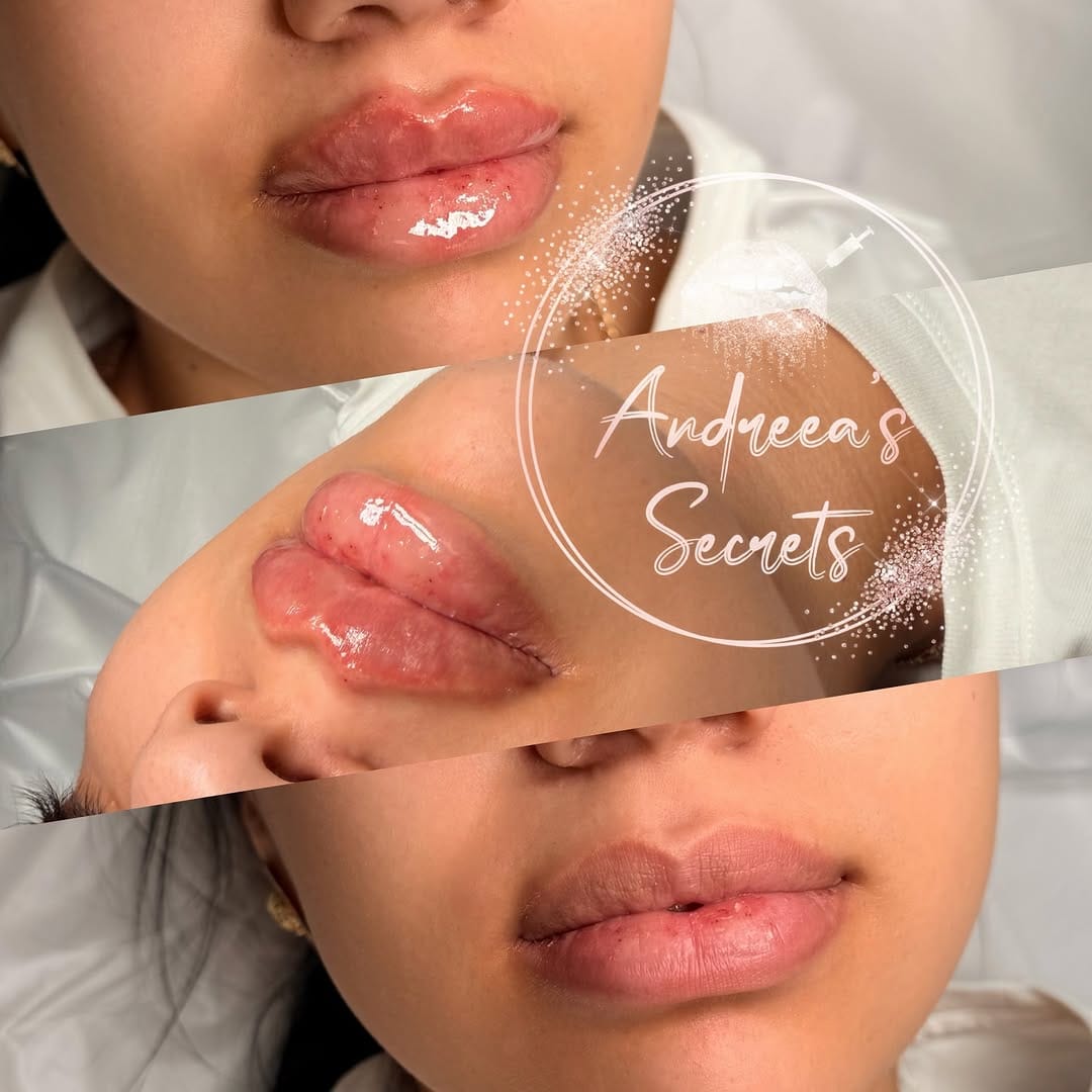 Post 5 by Andreea Rasinar on Instagram (image)