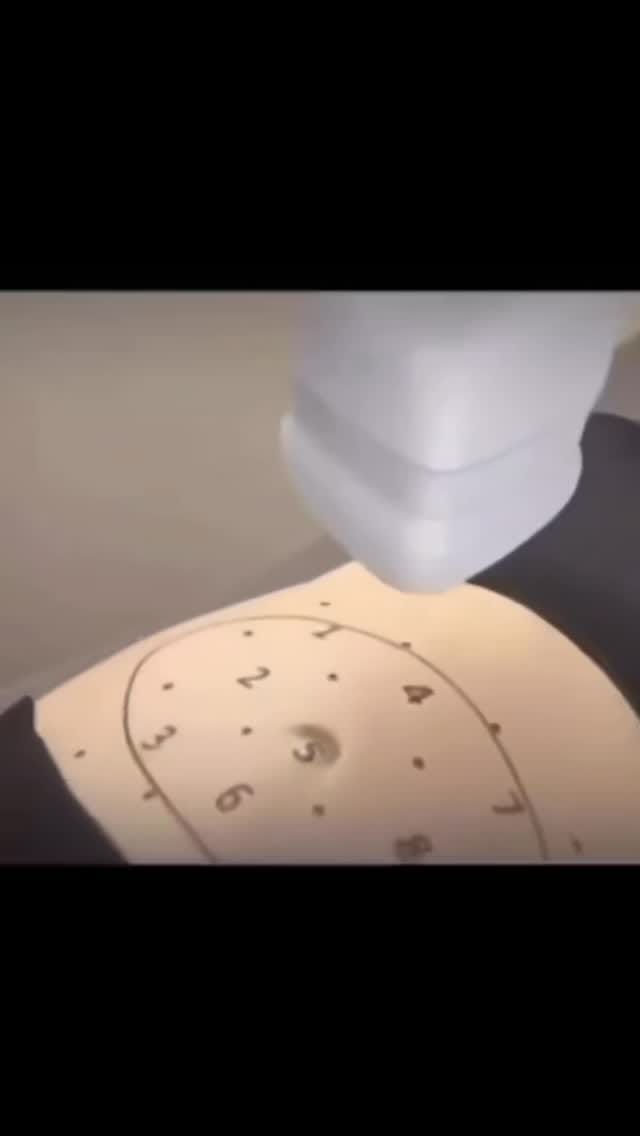 Post 7 by Laser Treatment Clinic Harley St London on Instagram (video)