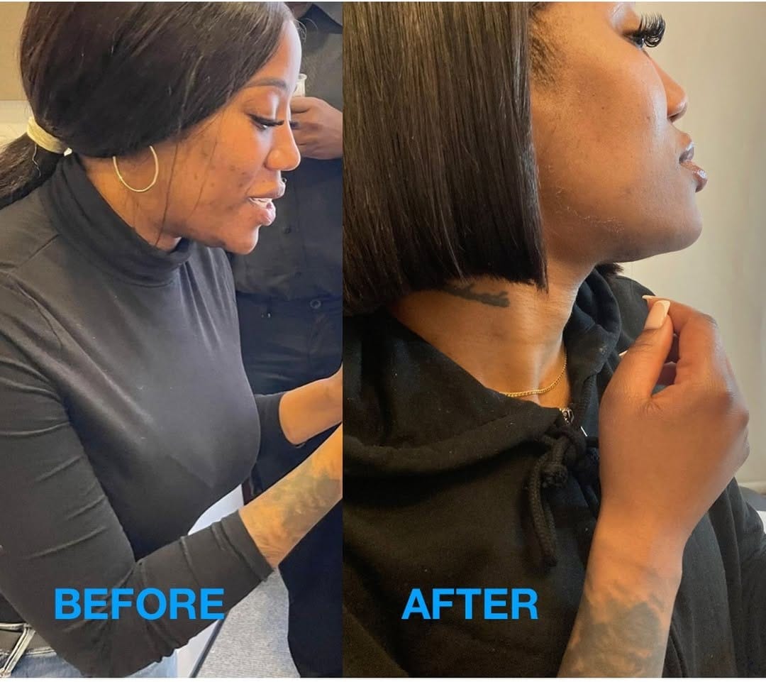 Post 9 by Laser Treatment Clinic Harley St London on Instagram (image)