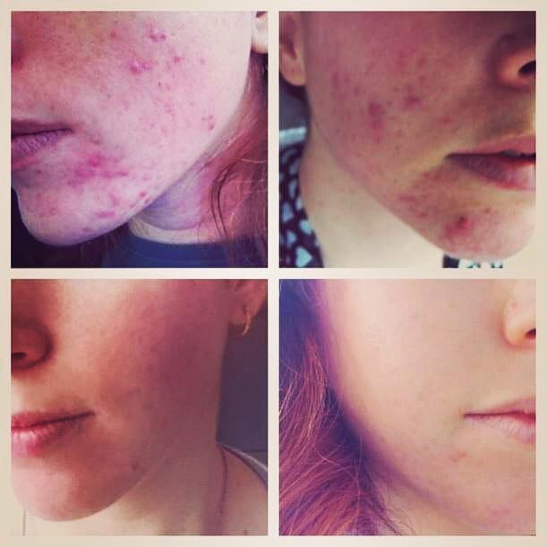 Post 10 by Laser Treatment Clinic Harley St London on Instagram (image)