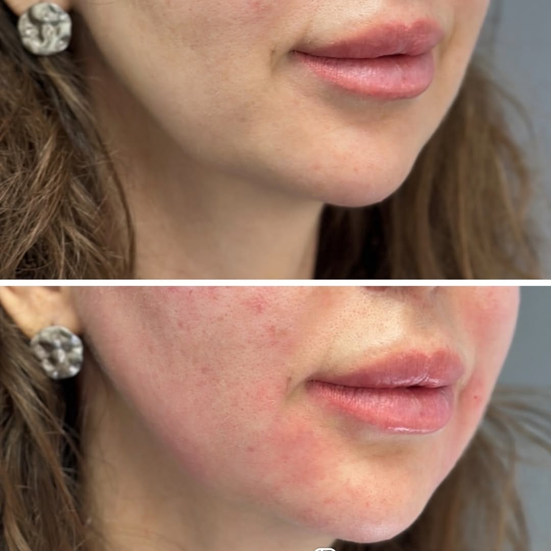 Post 1 by Dr dermatologist aesthetic practitioner London on Instagram (carousel)