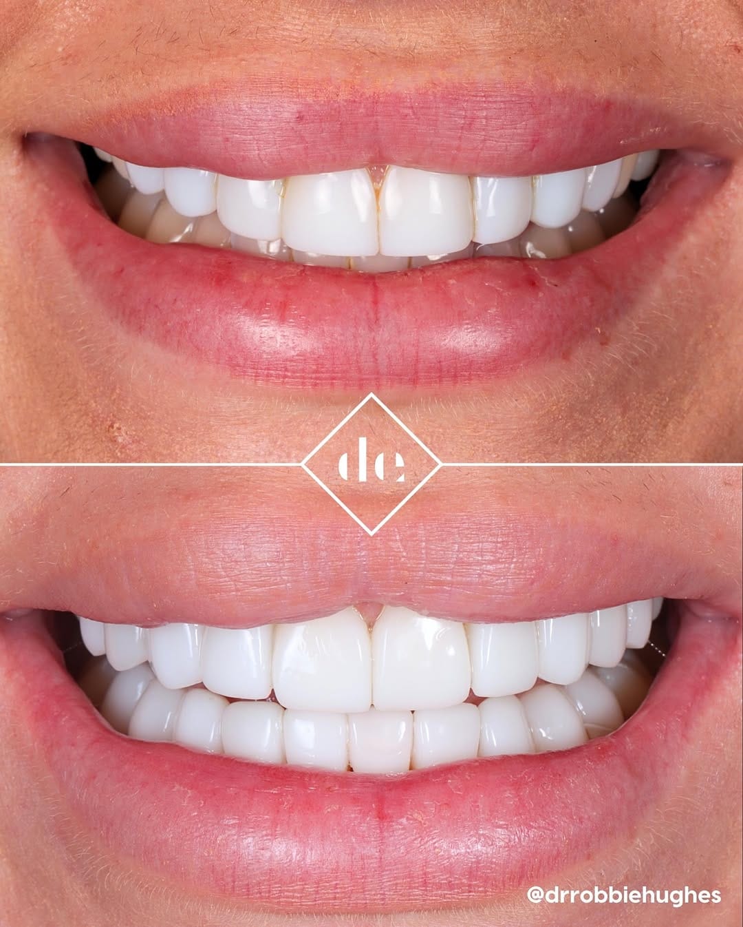 Post 3 by Dental Excellence UK on Instagram (carousel)