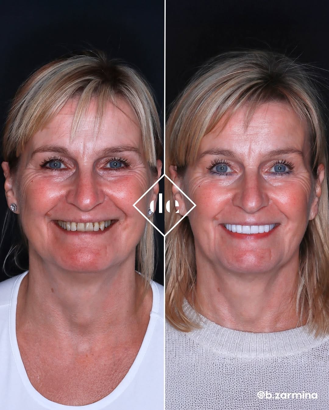 Post 1 by Dental Excellence UK on Instagram (carousel)