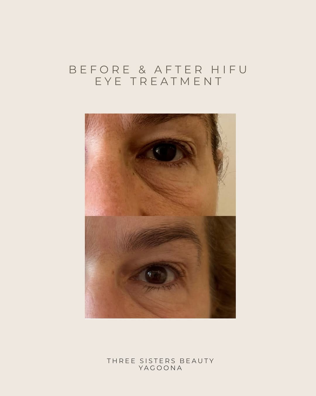 Post 8 by Three Sisters Beauty on Instagram (image)