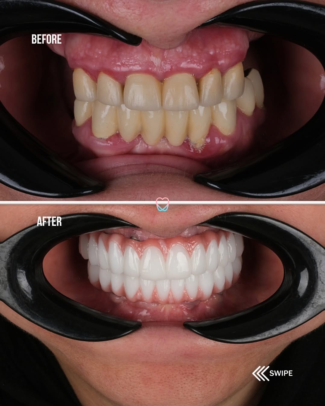 Post 6 by Dental Dream Turkey on Instagram (carousel)