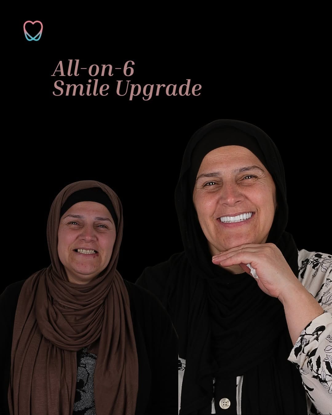 Post 5 by Dental Dream Turkey on Instagram (image)