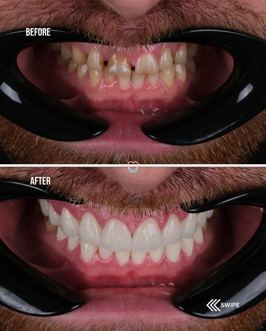 Post 3 by Dental Dream Turkey on Instagram (carousel)