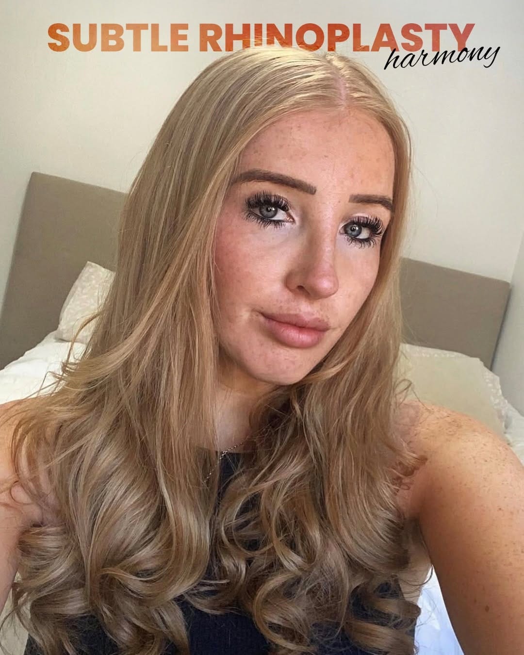 Post 9 by Clinichub Cosmetic Surgery on Instagram (carousel)