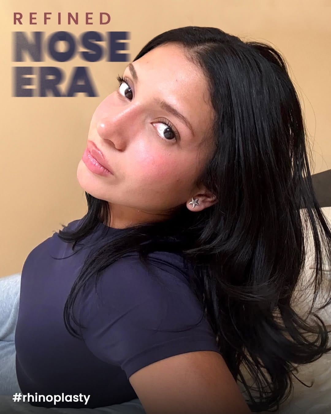 Post 4 by Clinichub Cosmetic Surgery on Instagram (carousel)