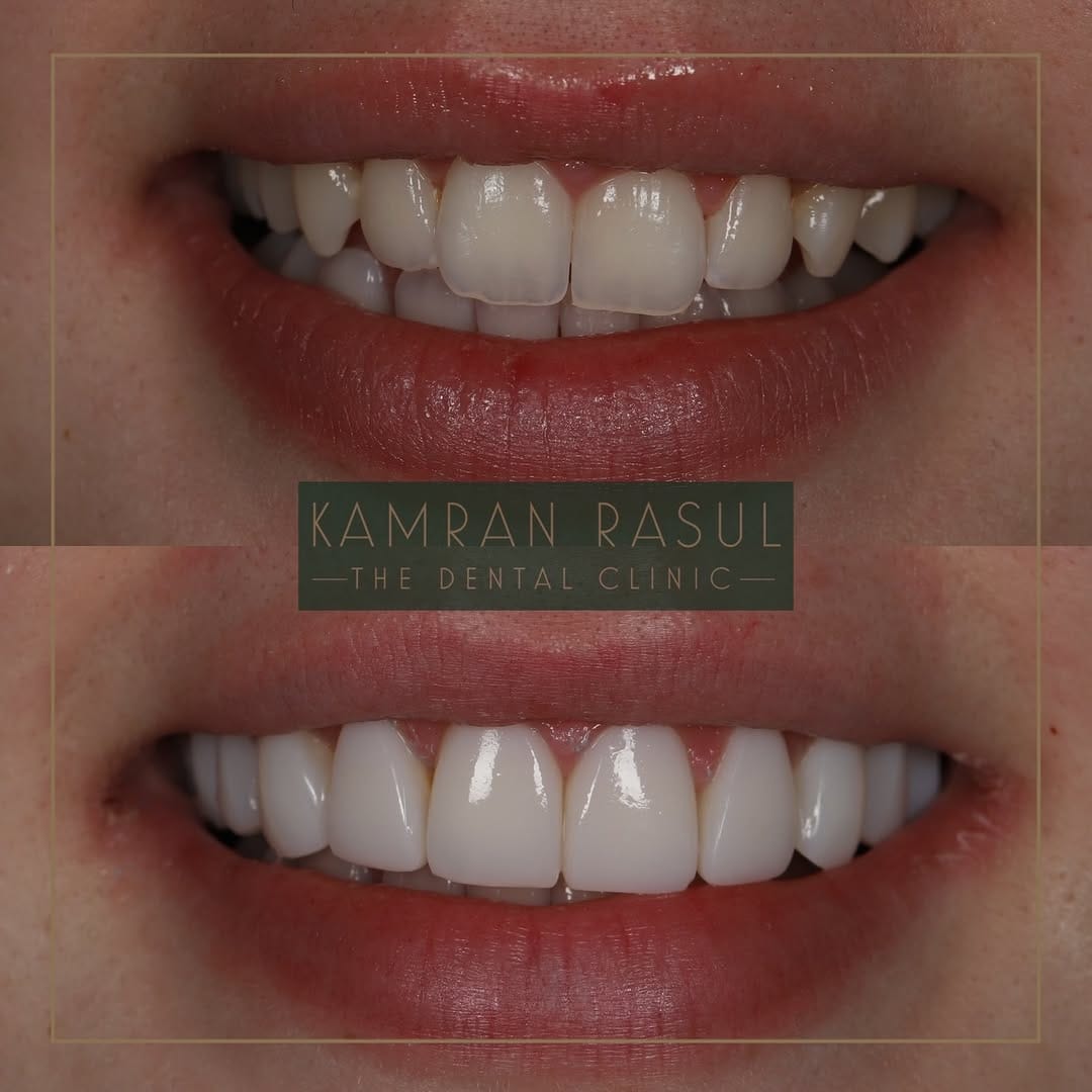 Post 4 by Kamran Rasul on Instagram (carousel)