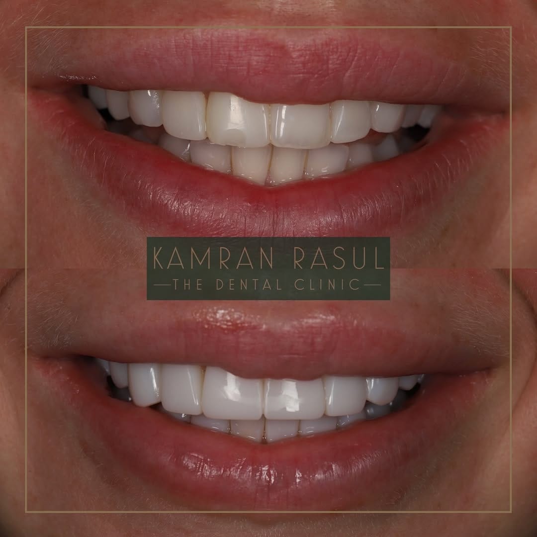 Post 10 by Kamran Rasul on Instagram (carousel)