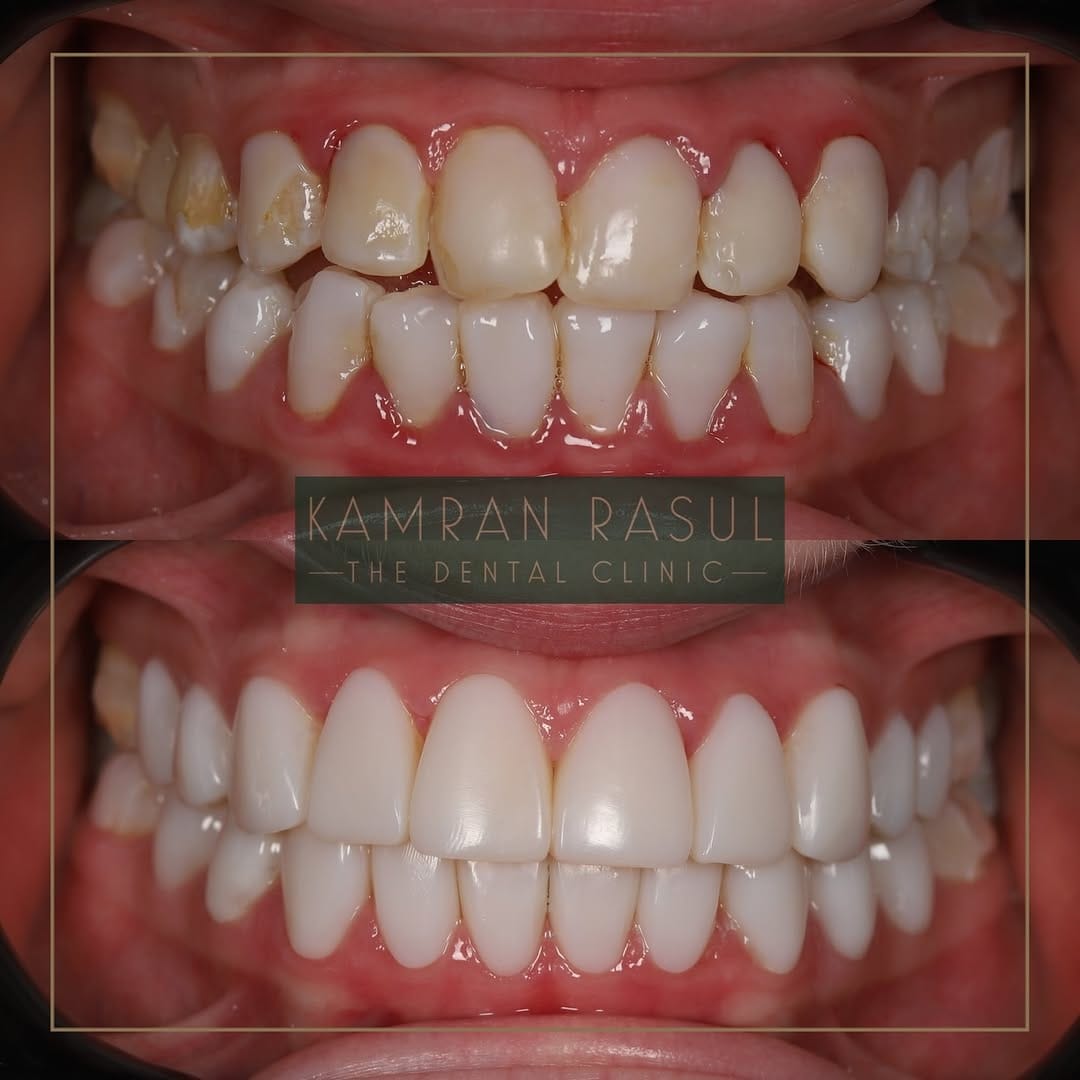 Post 8 by Kamran Rasul on Instagram (carousel)