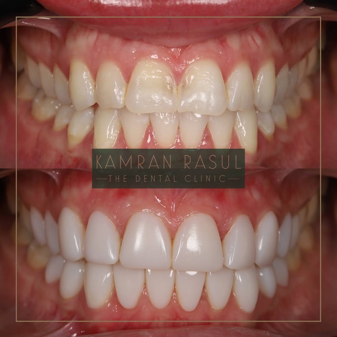 Post 7 by Kamran Rasul on Instagram (carousel)